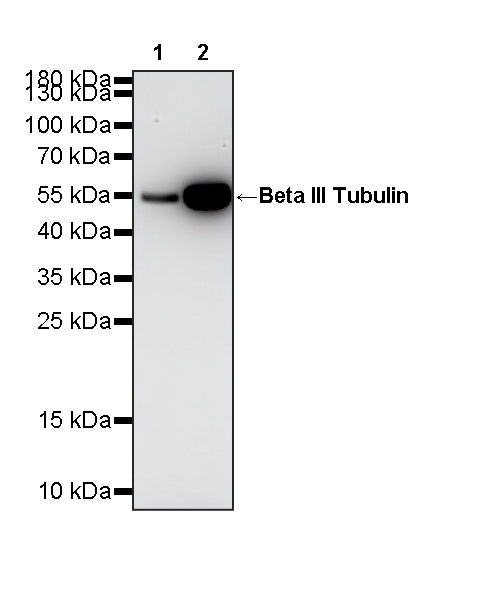 Beta III Tubulin Recombinant Rabbit mAb (S-5529)