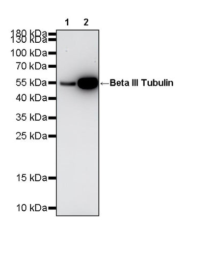 Beta III Tubulin Recombinant Rabbit mAb (S-5529)