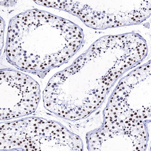Histone H3 (acetyl K4 + K9 + K18) Rabbit polyclonal antibody