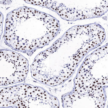 Histone H3 (acetyl K4 + K9 + K18) Rabbit polyclonal antibody