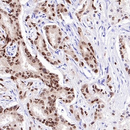 FOXA1 Recombinant Rabbit mAb, PBS Only  (SDT-2779-17)