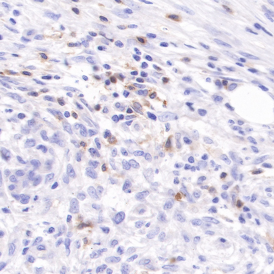 CD103 Recombinant Rabbit mAb (SDT-R134)