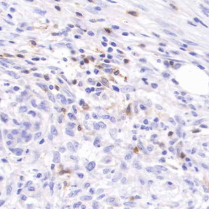 CD103 Recombinant Rabbit mAb (SDT-R134)