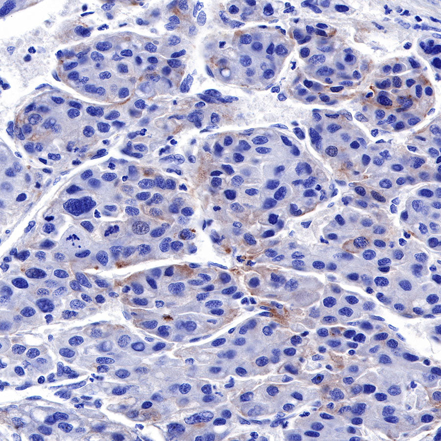 Glypican-3 Recombinant Rabbit mAb,PBS Only (SDT-R032)