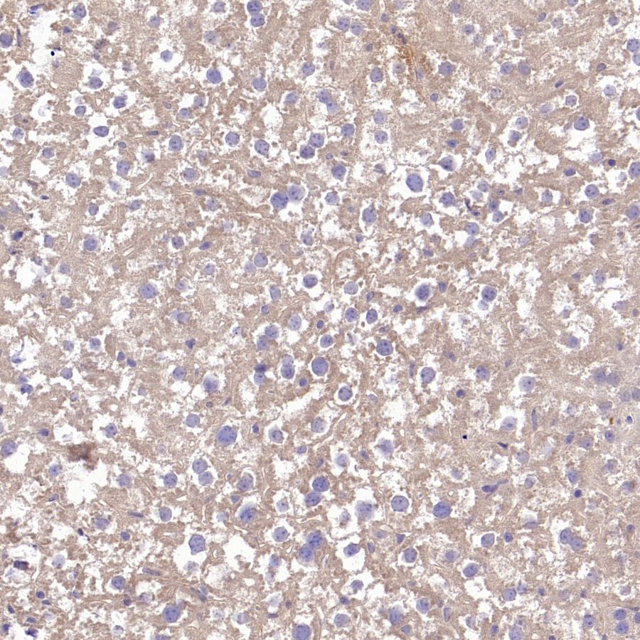 TYK2 Recombinant Rabbit mAb (S-2740-165)