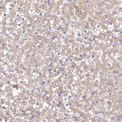 TYK2 Recombinant Rabbit mAb (S-2740-165)