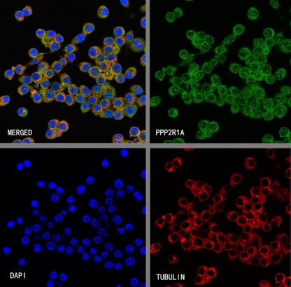 PPP2R1A Rabbit Polyclonal Antibody