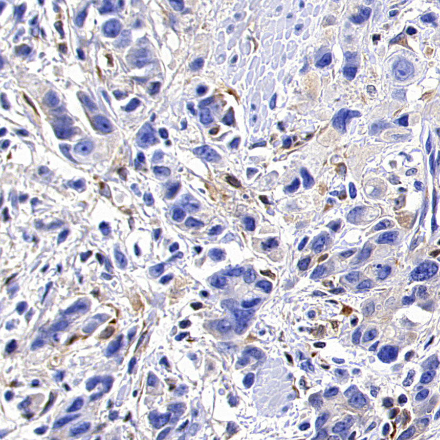 TIMP1 Recombinant Rabbit mAb (S-5147)