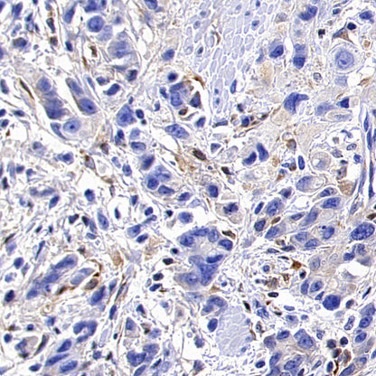 TIMP1 Recombinant Rabbit mAb (S-5147)