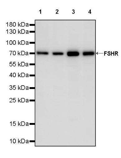 FSHR Recombinant Rabbit mAb (SDT-2269-36)