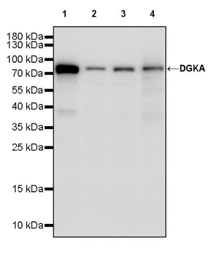 DGKA Recombinant Rabbit mAb (S-1933-121)