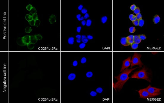 CD25/IL-2Rα Recombinant Rabbit mAb (S-548-137)