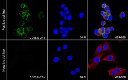CD25/IL-2Rα Recombinant Rabbit mAb (S-548-137)