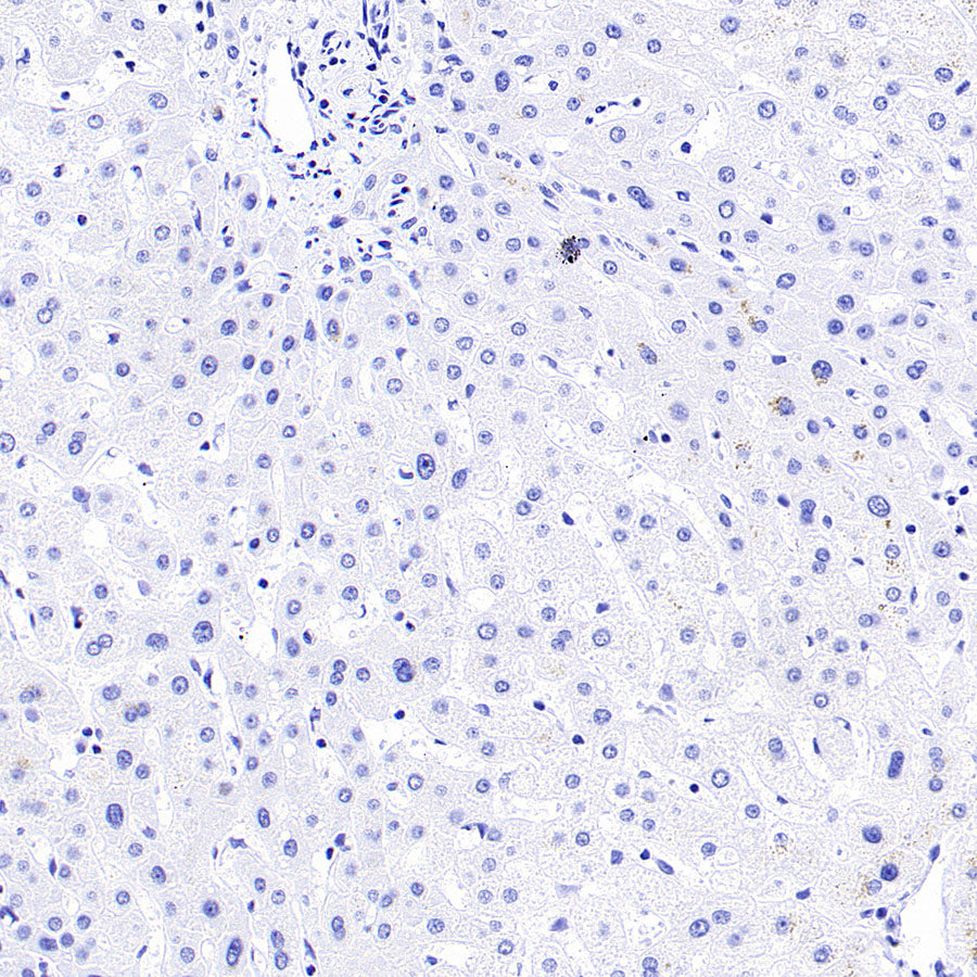 SHIP1 Recombinant Rabbit mAb (S-4235-32)