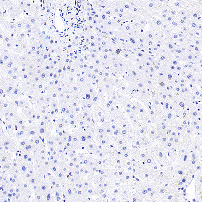 SHIP1 Recombinant Rabbit mAb (S-4235-32)