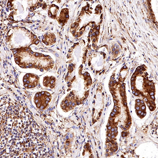 GRP94 Recombinant Rabbit mAb (S-R268)