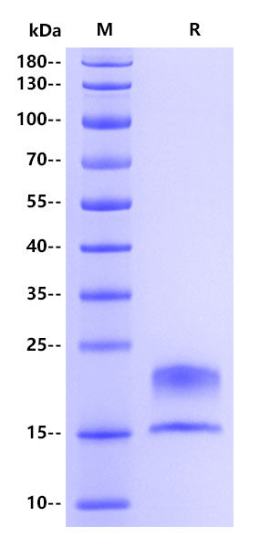 Epididymis protein 4(HE4) His Tag, Human