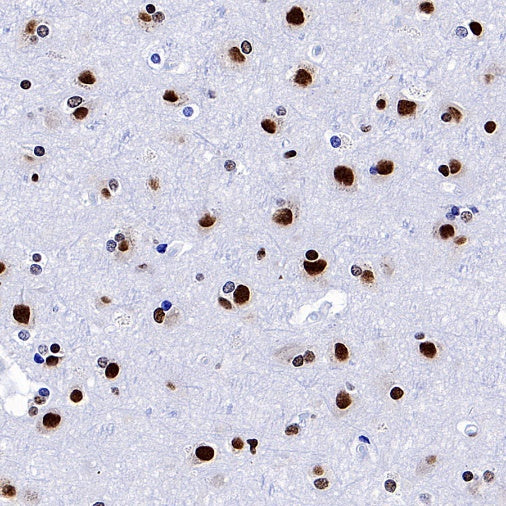 hnRNP H Rabbit Polyclonal Antibody