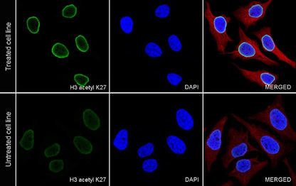 Histone H3 (acetyl K27) Rabbit pAb