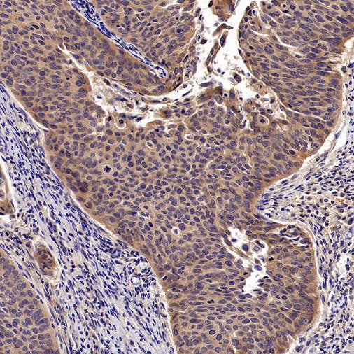 NF-κB2 p100 Recombinant Rabbit mAb (S-2502-62)