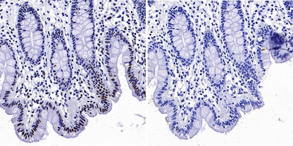 Phospho-NRF2 (Ser40) Recombinant Rabbit mAb (S-1720-97)