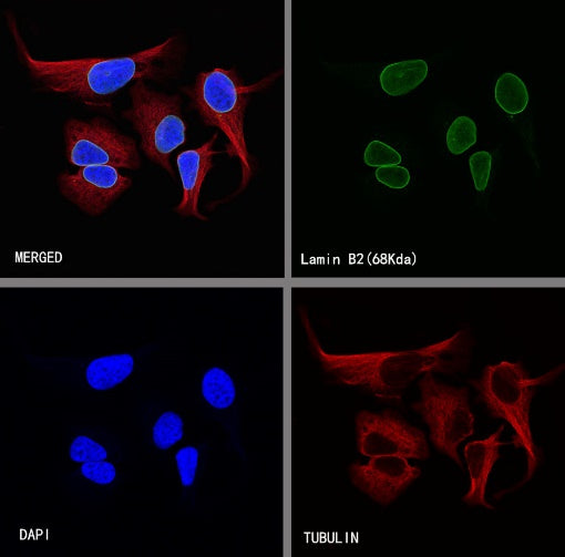 S-RMab®Lamin B2 Recombinant Rabbit mAb (S-951-70)
