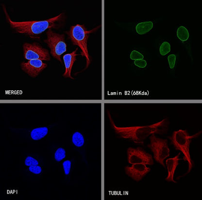 S-RMab®Lamin B2 Recombinant Rabbit mAb (S-951-70)
