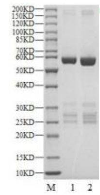 NEK6 GST Tag Protein, Human