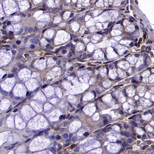 Stat5b Recombinant Rabbit mAb (S-2951-34)