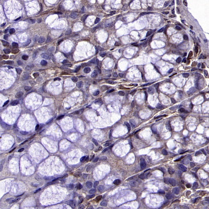 Stat5b Recombinant Rabbit mAb (S-2951-34)