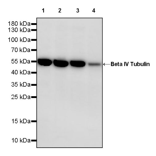 Beta IV Tubulin Recombinant Rabbit mAb (S-1572-30)