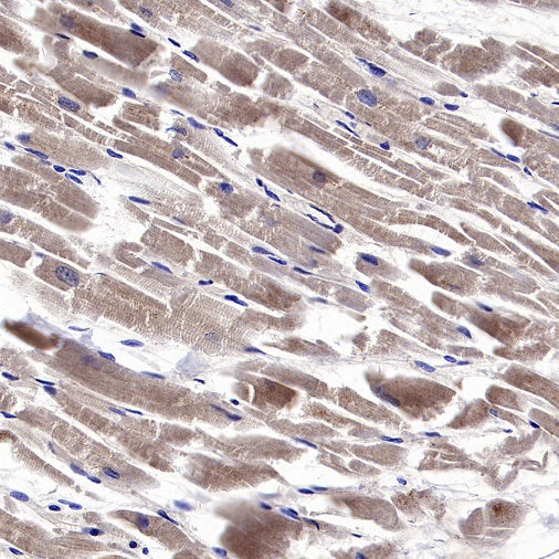SOD2/MnSOD (acetyl K68) Rabbit Polyclonal Antibody