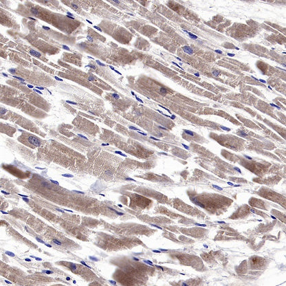 SOD2/MnSOD (acetyl K68) Rabbit Polyclonal Antibody