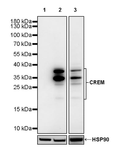 CREM Recombinant Rabbit mAb (S-3375-19)