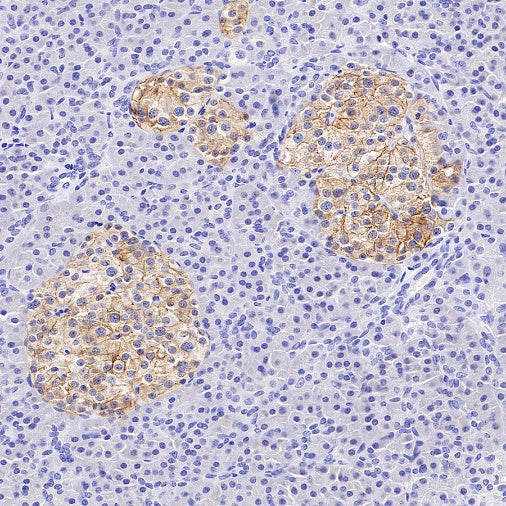 GLP1R Recombinant Rabbit mAb (S-2200-163)