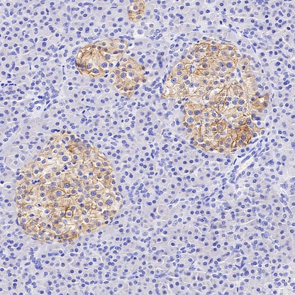 GLP1R Recombinant Rabbit mAb (S-2200-163)