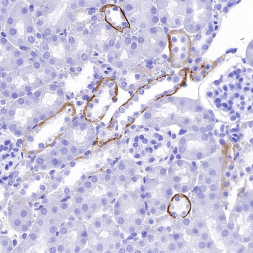 TACSTD2/TROP2 Recombinant Rabbit mAb (S-R237)