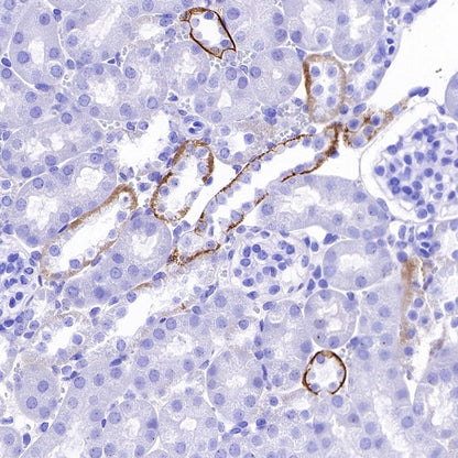 TACSTD2/TROP2 Recombinant Rabbit mAb (S-R237)