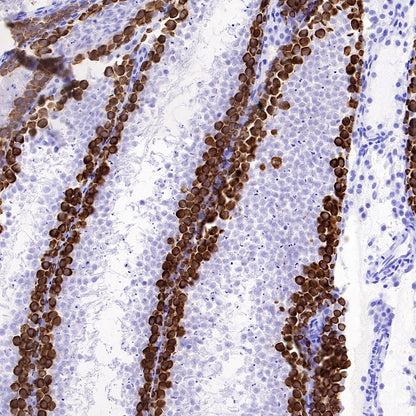 S-RMab® DAZL Recombinant Rabbit mAb (S-1588-3)