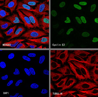 Cyclin E2 Recombinant Rabbit mAb (S-5247)