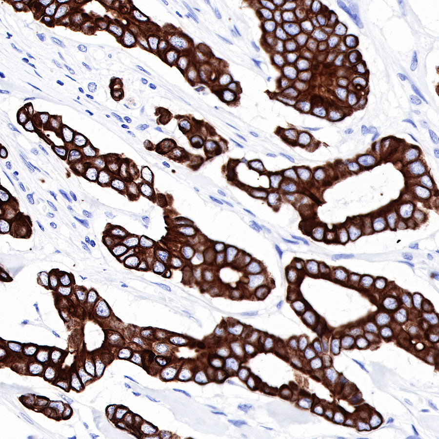 CK-LMW Recombinant Rabbit mAb (SDT-P003)