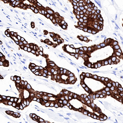 CK-LMW Recombinant Rabbit mAb (SDT-P003)