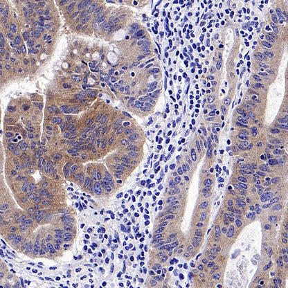 FACL4 Rabbit Polyclonal Antibody