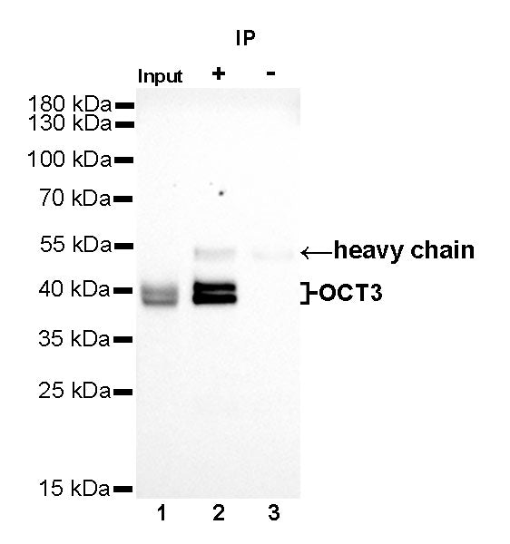 OCT3/4 Recombinant Rabbit mAb (SDT-165-76)