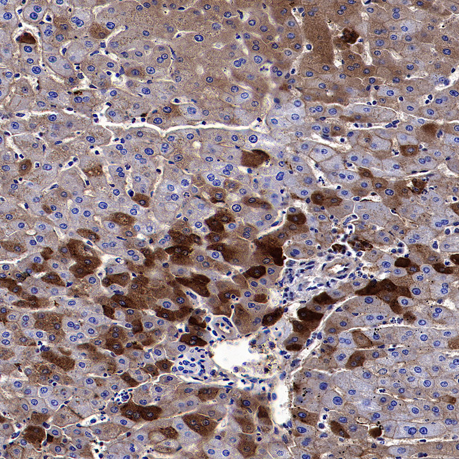 Serum Amyloid A Recombinant Rabbit mAb (S-5308)