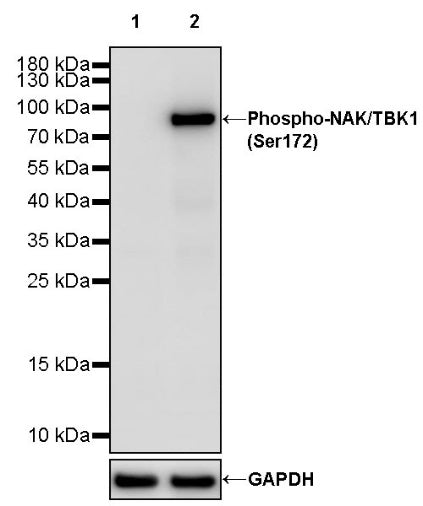 Phospho-NAK/TBK1 (Ser172) Recombinant Rabbit mAb (S-3182)