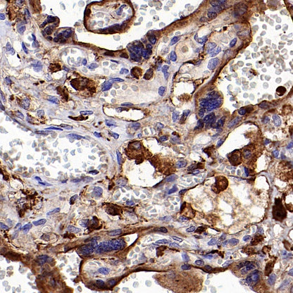 DAB2 Recombinant Rabbit mAb (S-2131-55)