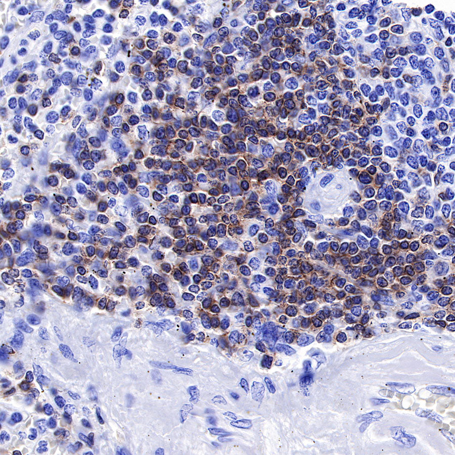 CD3 epsilon Recombinant Rabbit mAb (SDT-241-49)