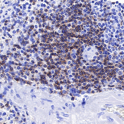 CD3 epsilon Recombinant Rabbit mAb (SDT-241-49)
