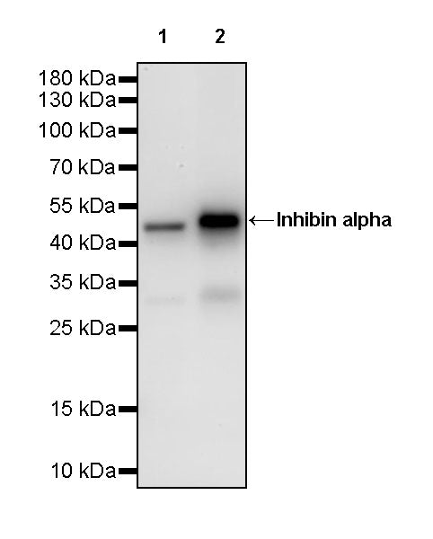 Inhibin alpha Recombinant Rabbit mAb (SDT-3212-24)